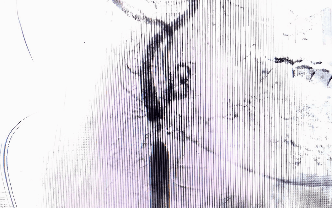 Carotid Artery Stenting
