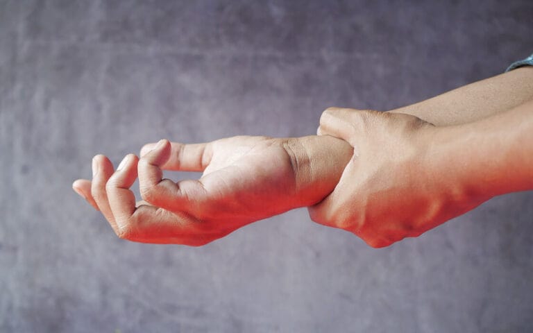 Carpal Tunnel Syndrome